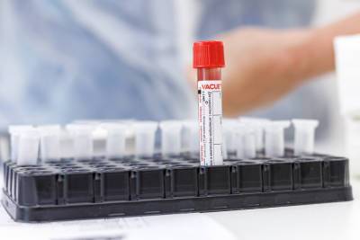 11 классов закрыли на карантин в Великих Луках из-за COVID-19 - mk-pskov.ru