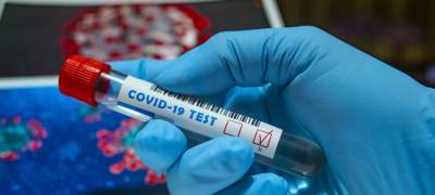 В России за время пандемии было проведено более 190 миллионов тестов на коронавирус - stolicaonego.ru - Россия