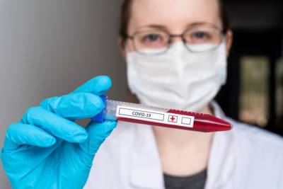 За сутки зафиксировали 6 552 новых случаев коронавируса - ru.slovoidilo.ua - Украина - Киев
