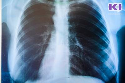 В Коми подтверждено еще 16 смертей от коронавируса - komiinform.ru - республика Коми