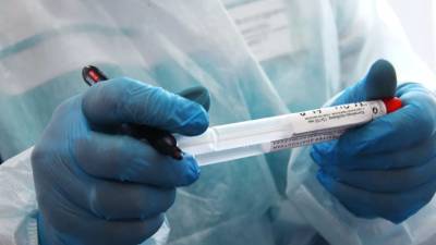 Дмитрий Беляков - Российские медработники сообщили, что первые симптомы COVID-19 можно спутать с гриппом - russian.rt.com