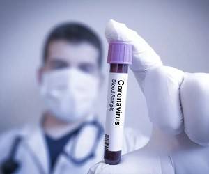 Новый «мю»-штамм коронавируса устойчив к вакцинам: нужно ли беспокоиться? - goodnews.ua - Колумбия