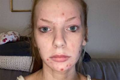 Новая внешность девушки после посещения косметолога восхитила ее фанатов - lenta.ru