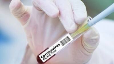 Ученый предсказал сроки окончания пандемии COVID-19 - penzainform.ru - Греция