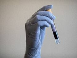 Ученые заявили об опасности повышенного иммунитета от COVID - newsland.com - Лос-Анджелес