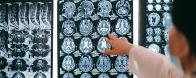 Ученые Гарвардского университета выявили причину развития рассеянного склероза у человека - runews24.ru - Сша