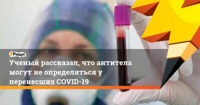 Виталий Зверев - Ученый рассказал, что антитела могут не определяться у перенесших COVID-19 - ridus.ru - Россия - Япония