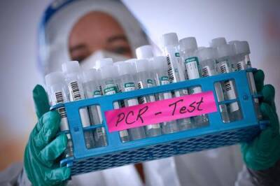 Александр Гинцбург - Business Insider: люди, заразившиеся «омикроном» после вакцинации, могут приобрести «супериммунитет» - argumenti.ru - Сша