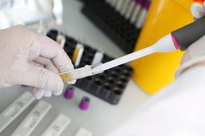 Более 241,7 млн тестов на коронавирус провели в России - tvc.ru - Россия