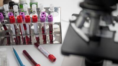 Epidemic: пациенты с первой группой крови более активно распространяют COVID-19 - inforeactor.ru