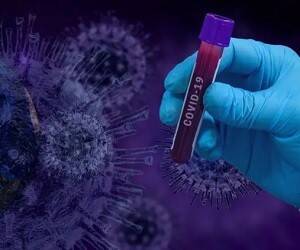 Во Франции нашли новый штамм коронавируса с почти полусотней мутаций - goodnews.ua - Франция - Камерун