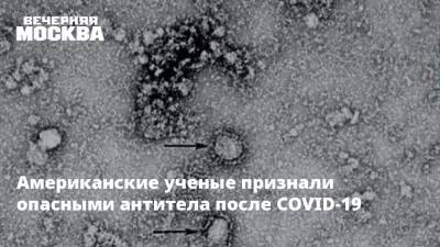 Джордж Мейсон Анч - Американские ученые признали опасными антитела после COVID-19 - vm.ru - Лос-Анджелес