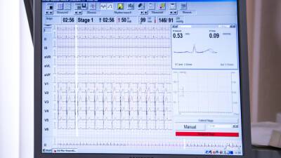 Исследование: После COVID-19 повышается риск сердечного приступа - mir24.tv - Сша - Вашингтон