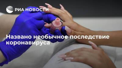 Николай Крючков - Иммунолог Крючков предупредил, что ногти после COVID-19 могут стать ломкими - ria.ru - Россия - Москва