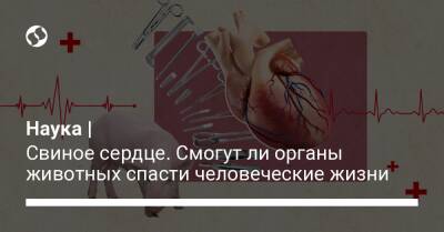 Наука | Свиное сердце. Смогут ли органы животных спасти человеческие жизни - liga.net - Украина - Сша
