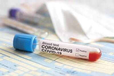 Зарегистрирован первый случай коронавируса среди участников выборов федерального президента - rusverlag.de - Президент