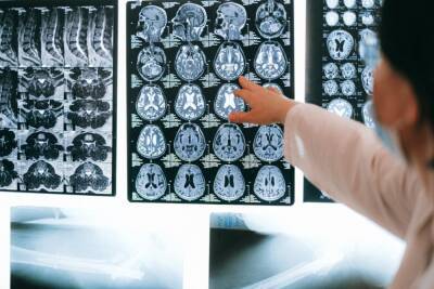 Ученые назвали возраст начала замедления когнитивных процессов в мозге - abnews.ru - Германия