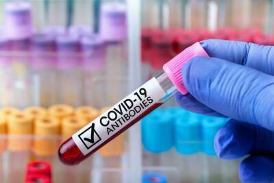Американские иммунологи: спустя 6 месяцев после вакцинации антитела против COVID-19 становятся мощнее - news.israelinfo.co.il - Сша - Израиль - Вашингтон