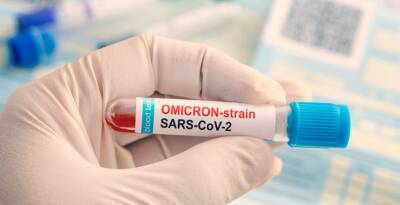 Частные лаборатории в Новосибирске начали делать тесты на наличие омикрон-штамма COVID-19 - runews24.ru - Россия - Новосибирск
