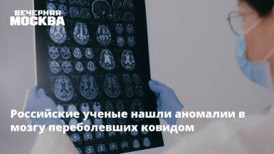 Александр Горелов - Российские ученые нашли аномалии в мозгу переболевших ковидом - vm.ru - Россия