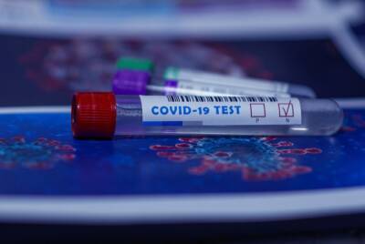 В России в несколько раз выросли продажи экспресс-тестов на коронавирус - abnews.ru - Россия