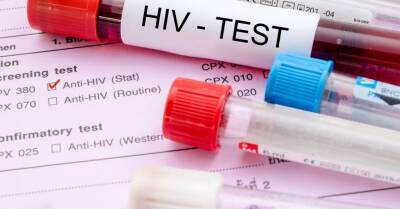 В Нидерландах обнаружен новый, более опасный вариант ВИЧ - rus.delfi.lv - Голландия - Швейцария - Латвия - Бельгия
