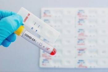 Минздрав: QR-код по результатам теста на антитела можно будет получить уже с … - vologda-poisk.ru - Россия - Минздрав