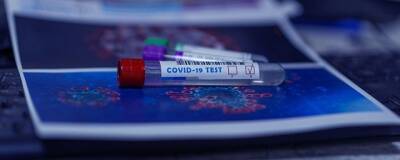 В России приступили к испытанию кожного теста на антитела к COVID-19 - runews24.ru - Россия