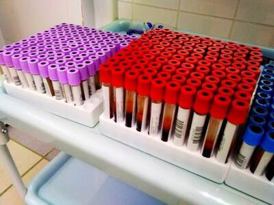 Ученые из США выявили группу крови, повышающую риск тяжелого течения COVID-19 - ufacitynews.ru - Сша