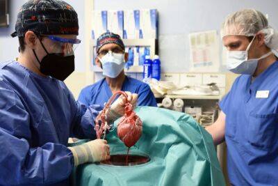 Мужчина с сердцем генетически модифицированной свиньи мог умереть из-за того, что животное было заражено цитомегаловирусом - itc.ua - Украина - штат Мэриленд