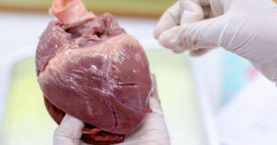 Первая пересадка сердца от свиньи человеку: ученые выяснили, почему она потерпела неудачу - focus.ua - Украина - Сша - штат Мэриленд