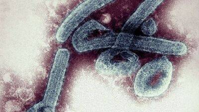 Гана сообщает о первой вспышке вируса Марбург - unn.com.ua - Украина - Киев - Кения - Юар - Конго - Ангола - Уганда - Гвинея - Гана