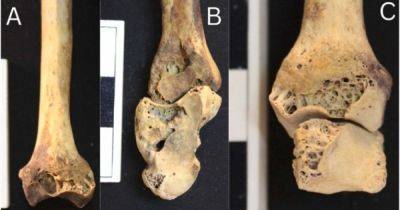 В 3500-летнем скелете обнаружили опасную болезнь: один из самых древних примеров в мире (фото) - focus.ua - Украина - Египет - Судан