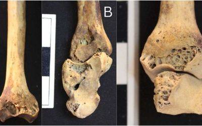 В 3500-летнем скелете обнаружили опасную болезнь суставов - planetanovosti.com - Египет
