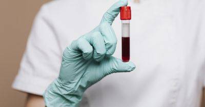 5 удивительных секретов, которые группа крови может рассказать о вашем здоровье - focus.ua - Украина