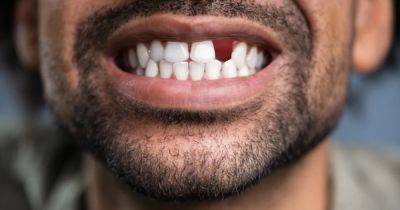 Утраченные коренные зубы смогут вновь отрасти: новое лекарство впервые испытают на людях - focus.ua - Украина - Япония