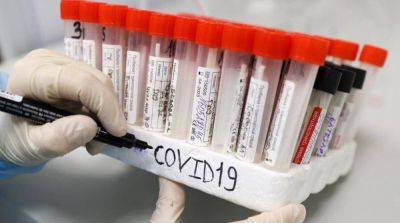 В Киеве резко возросло количество госпитализированных из-за Covid-19 - ru.slovoidilo.ua - Украина - Киев