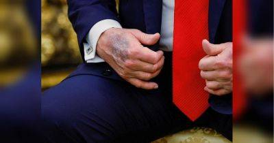 Дональд Трамп - Мелания Трамп - король Чарльз - Осталось жить всего несколько месяцев: загадочное фото спровоцировало спекуляции о здоровье президента США - fakty.ua - Украина - Сша - Англия - Вашингтон - Южная Корея